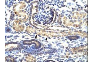 Image no. 1 for anti-SNAIL (SNAI1) (N-Term) antibody (ABIN6735858)