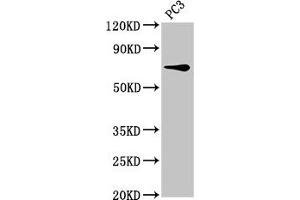 Western Blot Positive WB detected in: PC-3 whole cell lysate All lanes: SCNN1B antibody at 8 μg/mL Secondary Goat polyclonal to rabbit IgG at 1/50000 dilution Predicted band size: 73, 78 kDa Observed band size: 73 kDa (SCNN1B 抗体  (AA 554-640))