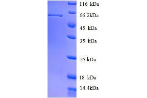 SDS-PAGE (SDS) image for Keratin 8 (KRT8) (AA 2-483) protein (His-SUMO Tag) (ABIN1047299)