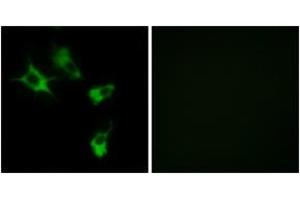 Immunofluorescence analysis of COS7 cells, using MAST4 Antibody. (MAST4 抗体  (AA 251-300))