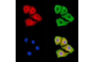 ABIN7094909 and ABIN7098963 staining Hela cells by IF/ICC. (IL23 抗体)