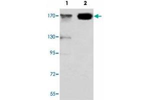 Western blot analysis of JARID1C monoclonal antibody  at 1:1000 dilution. (KDM5C 抗体  (C-Term))