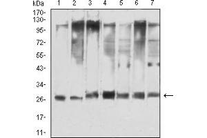Western blot analysis using YWHAQ mouse mAb against Hela (1), NIH/3T3 (2), C6 (3), A549 (4), COS7 (5), PC-12 (6), and HEK293 (7) cell lysate. (14-3-3 theta 抗体  (AA 1-245))