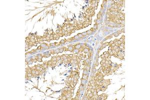 Immunohistochemistry of paraffin-embedded mouse testis using USP9Y Rabbit pAb (ABIN7271171) at dilution of 1:150 (40x lens). (USP9Y 抗体)