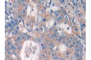 Immunohistochemistry (IHC) image for anti-Interleukin 33 (IL33) (AA 112-270) antibody (ABIN7426418)