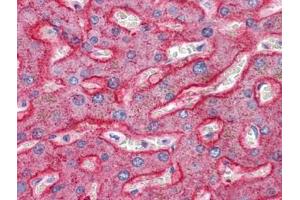Human Liver: Formalin-Fixed, Paraffin-Embedded (FFPE) (SQSTM1 抗体  (C-Term))