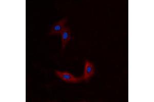 Immunofluorescent analysis of BMX staining in A549 cells. (BMX 抗体  (N-Term))