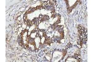 IHC analysis of CBR1 using anti-CBR1 antibody (ABIN7600015). (CBR1 抗体  (AA 14-262))