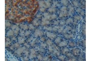 Immunohistochemistry (IHC) image for anti-Insulin-Like Growth Factor Binding Protein 7 (IGFBP7) (AA 88-281) antibody (ABIN7439126)