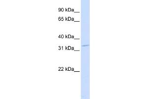 WB Suggested Anti-OTX2 Antibody Titration:  0. (OTX2 抗体  (Middle Region))
