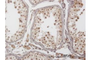 Immunoperoxidase of monoclonal antibody to PIM1 on formalin-fixed paraffin-embedded human testis. (PIM1 抗体  (AA 1-100))