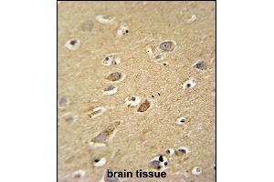 Immunohistochemistry (Paraffin-embedded Sections) (IHC (p)) image for anti-ATP Synthase, H+ Transporting, Mitochondrial Fo Complex, Subunit D (ATP5H) (AA 68-97) antibody (ABIN654144)