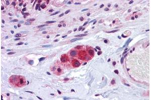 Human Small Intestine, Submucosal Plexus: Formalin-Fixed, Paraffin-Embedded (FFPE)