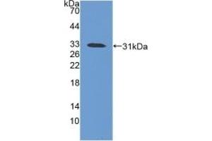 Detection of Recombinant iNV, Mouse using Polyclonal Antibody to Involucrin (INV) (Involucrin 抗体  (AA 301-460))
