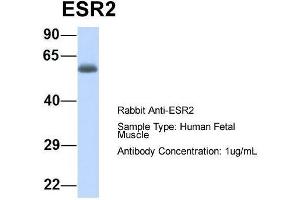Host:  Rabbit  Target Name:  ESR2  Sample Type:  Human Fetal Muscle  Antibody Dilution:  1. (ESR2 抗体  (N-Term))