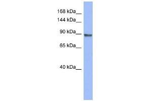 WB Suggested Anti-PML Antibody Titration:  0. (PML 抗体  (Middle Region))