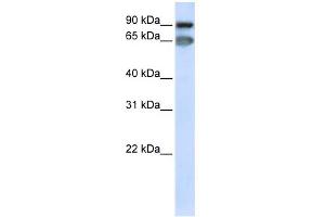 WB Suggested Anti-MED16 Antibody Titration: 0. (MED16 抗体  (C-Term))