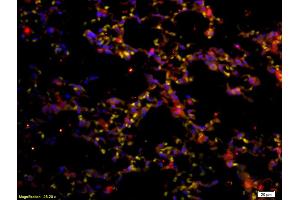 Formalin-fixed and paraffin embedded mouse lung labeled with Anti-CD45 Polyclonal Antibody, Unconjugated (ABIN669606) at 1:200 followed by conjugation to the secondary antibody Goat Anti-Rabbit IgG, PE conjugated used at 1:200 dilution for 40 minutes at 37°C (CD45 抗体  (AA 1210-1304))