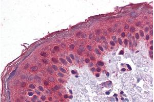 ABIN308431 (3. (SAR1A 抗体  (Internal Region))
