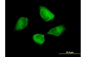 Immunofluorescence of purified MaxPab antibody to PDCD6IP on HeLa cell. (ALIX 抗体  (AA 1-868))