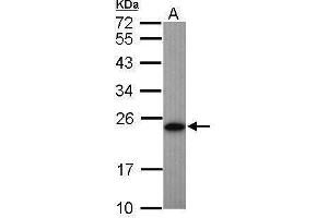 WB Image Sample (50 ug of whole cell lysate) A: Mouse brown adipose tissue 12% SDS PAGE antibody diluted at 1:1000 (Adenylate Kinase 1 抗体)