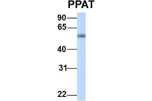 Host:  Rabbit  Target Name:  PPAT  Sample Type:  Human Fetal Muscle  Antibody Dilution:  1. (PPAT 抗体  (C-Term))