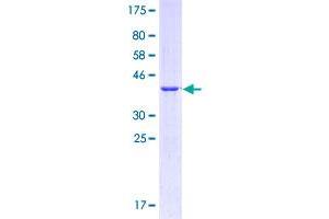 Image no. 1 for CD36 (CD36) (AA 347-446) protein (GST tag) (ABIN2565145)