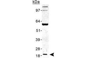 Western blot analysis of TMED10 in human liver lysate with TMED10 polyclonal antibody . (TMED10 抗体  (AA 100-200))