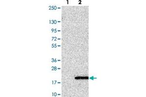 Western blot analysis of Lane 1: Negative control (vector only transfected HEK293T lysate). (UFSP1 抗体)