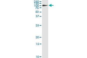 Immunoprecipitation of FBLN1 transfected lysate using anti-FBLN1 monoclonal antibody and Protein A Magnetic Bead , and immunoblotted with FBLN1 MaxPab rabbit polyclonal antibody. (Fibulin 1 抗体  (AA 151-250))