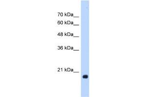 WB Suggested Anti-HSPB6 Antibody Titration:  1. (HSPB6 抗体  (Middle Region))