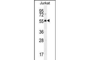 PODNL1 Antibody (Center) (ABIN656141 and ABIN2845479) western blot analysis in Jurkat cell line lysates (35 μg/lane). (PODNL1 抗体  (AA 167-195))