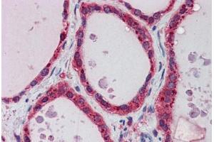 Human Thyroid: Formalin-Fixed, Paraffin-Embedded (FFPE) (AKR1B1 抗体  (N-Term))
