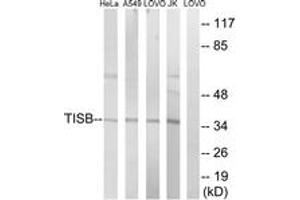 Western blot analysis of extracts from Jurkat/HeLa/A549/LOVO cells, using TISB (Ab-92) Antibody. (ZFP36L1 抗体  (AA 58-107))