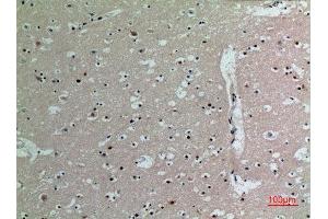 Immunohistochemistry (IHC) analysis of paraffin-embedded Human Brain, antibody was diluted at 1:100. (IL16 抗体  (C-Term))