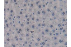 IHC-P analysis of Rat Liver Tissue, with DAB staining. (PTPRJ 抗体  (AA 1033-1277))
