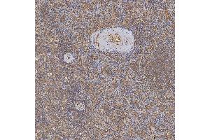 IHC analysis of SFXN3 using anti-SFXN3 antibody (ABIN7601302).