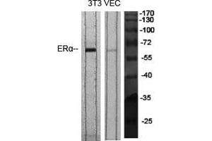 Western Blot (WB) analysis of specific cells using ERalpha Polyclonal Antibody. (Estrogen Receptor alpha 抗体  (Ser364))