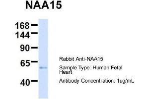 Host:  Rabbit  Target Name:  NAA15  Sample Type:  Human Fetal Heart  Antibody Dilution:  1. (NAA15 抗体  (N-Term))