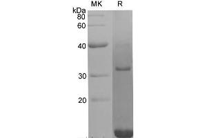 Western Blotting (WB) image for Platelet Derived Growth Factor Subunit B (PDGFB) protein (His tag) (ABIN7321293) (PDGFB Protein (His tag))