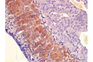 Immunohistochemistry (Paraffin-embedded Sections) (IHC (p)) image for anti-Plasminogen Activator, Urokinase Receptor (PLAUR) (AA 201-300) antibody (ABIN675443)