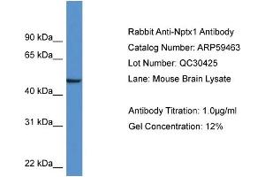Western Blotting (WB) image for anti-Neuronal Pentraxin 1 (NPX1) (Middle Region) antibody (ABIN2788076) (NPX1 抗体  (Middle Region))