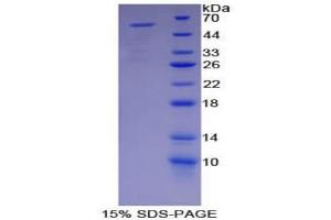SDS-PAGE analysis of Mouse MYH2 Protein. (MYH2 蛋白)