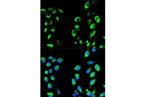 Immunofluorescence (IF) image for anti-Nuclear Factor of kappa Light Polypeptide Gene Enhancer in B-Cells Inhibitor, alpha (NFKBIA) (AA 1-317) antibody (ABIN3021668)