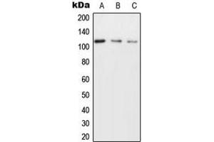 Western blot analysis of NICE4 expression in MCF7 (A), SP2/0 (B), H9C2 (C) whole cell lysates.
