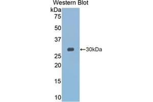 Western blot analysis of the recombinant protein. (GZMK 抗体  (AA 27-264))