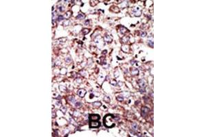 Immunohistochemistry (IHC) image for anti-Farnesyltransferase, CAAX Box, alpha (FNTA) antibody (ABIN3001525) (FNTA 抗体)