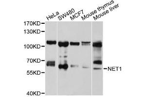Western blot analysis of extracts of various cell lines, using NET1 antibody (ABIN5970555) at 1/1000 dilution. (NET1 抗体)