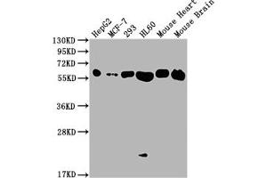 Western Blot Positive WB detected in: HepG2 whole cell lysate, MCF-7 whole cell lysate, 293 whole cell lysate, HL60 whole cell lysate, Mouse Heart tissue, Mouse Brain tissue All lanes: ATP5F1A antibody at 1:2000 Secondary Goat polyclonal to rabbit IgG at 1/50000 dilution Predicted band size: 60, 55, 58 kDa Observed band size: 60 kDa (Recombinant ATP5A1 抗体)