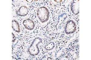 IHC analysis of ADK using anti-ADK antibody (ABIN4886430). (ADK 抗体  (AA 165-351))